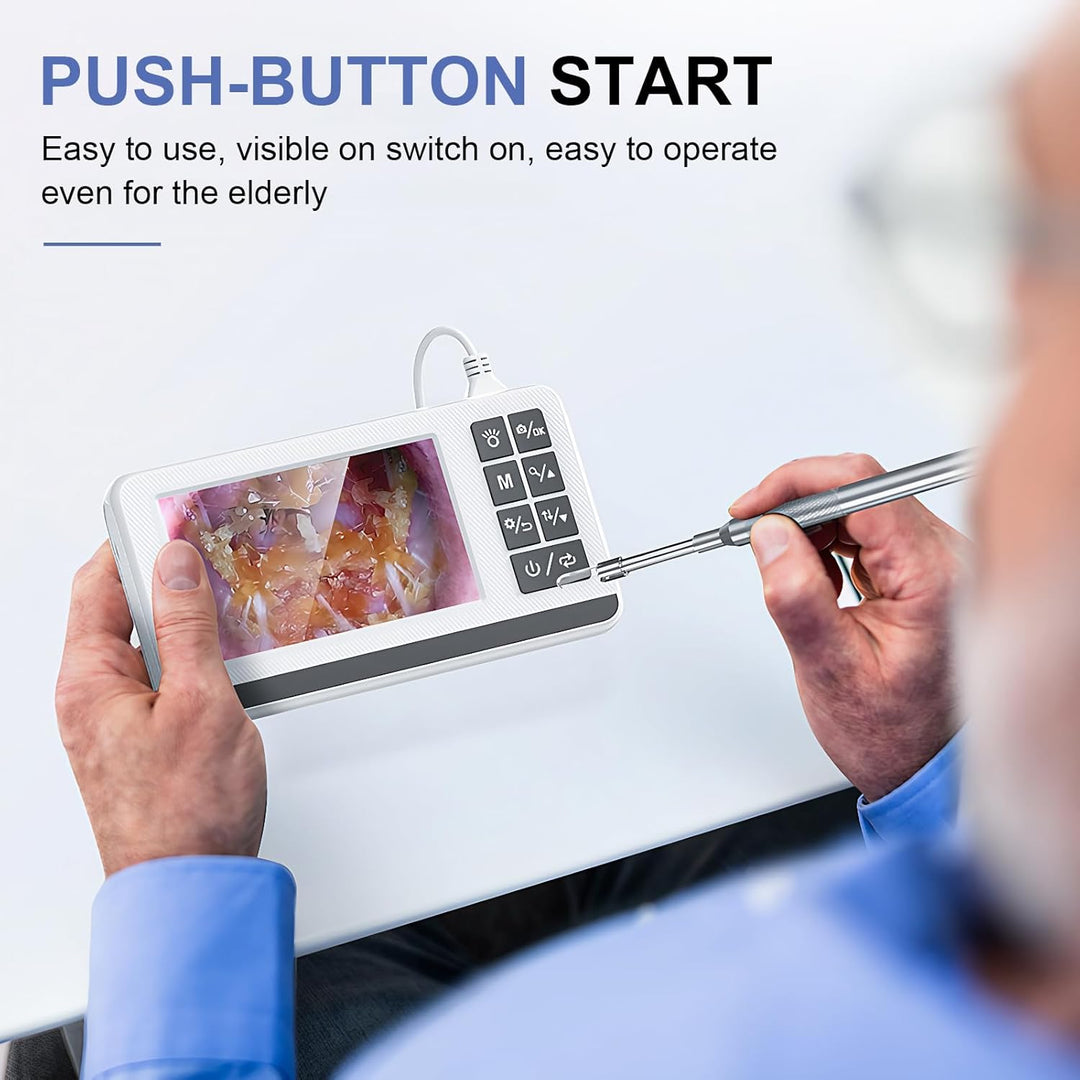 Ear Cleaning Otoscope with 3.9mm Camera and 4.3-Inch HD Screen – Claryon