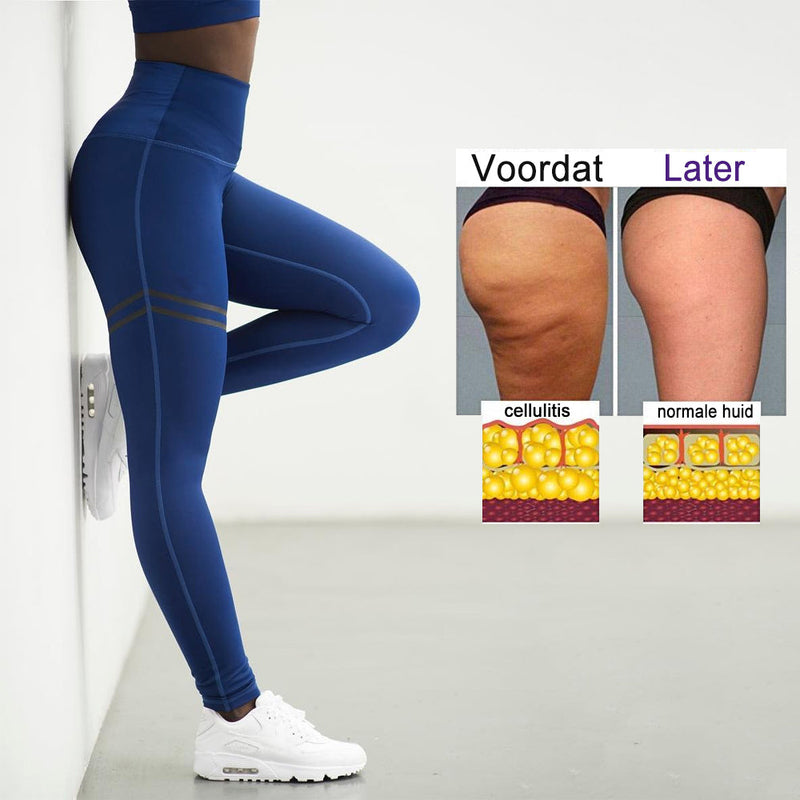 Anti-Cellulite Compression Leggings for Women - SculptFit-Black-S-State of Style