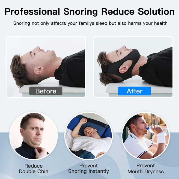 Anti-Snore Chin Strap – DreamQuiet-State of Style