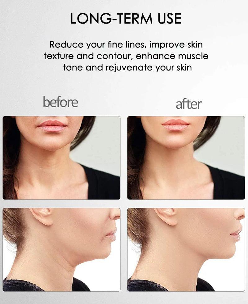 FirmGlow Microcurrent Facial Massager-State of Style
