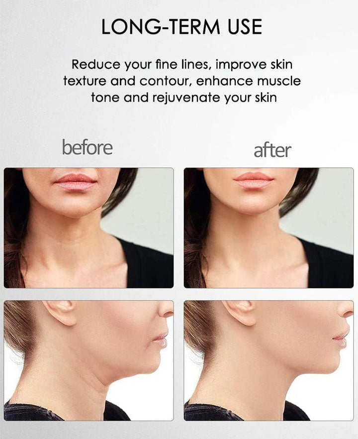 FirmGlow Microcurrent Facial Massager-State of Style