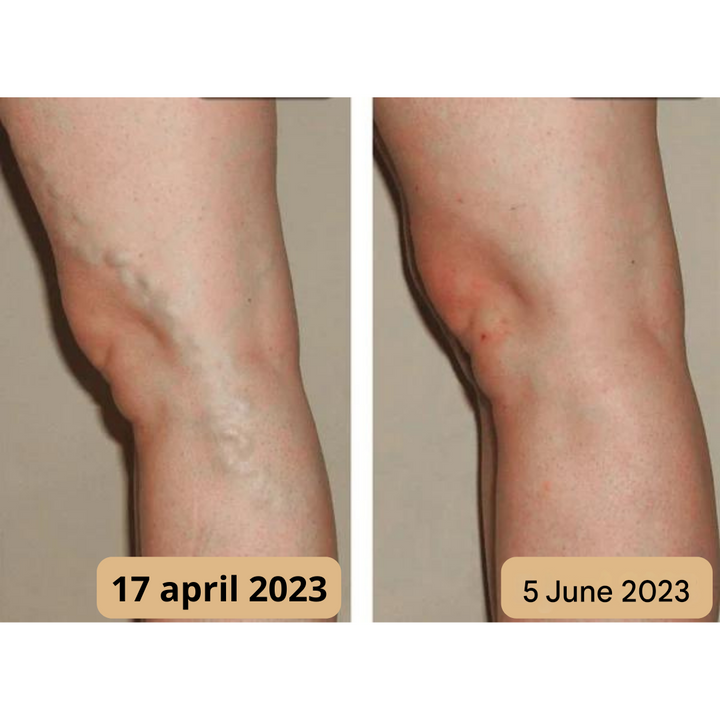 Foot Massage Mat - AcupressureFlow-State of Style