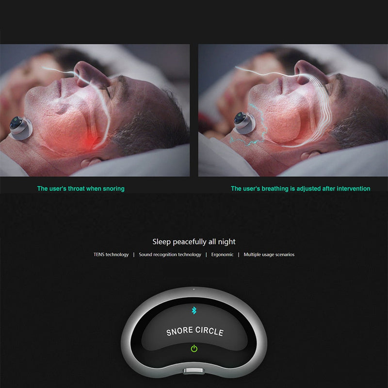 Slim Anti-Snoring Device - SleepEase-State of Style