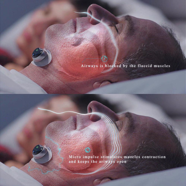 Slim Anti-Snoring Device - SleepEase-State of Style