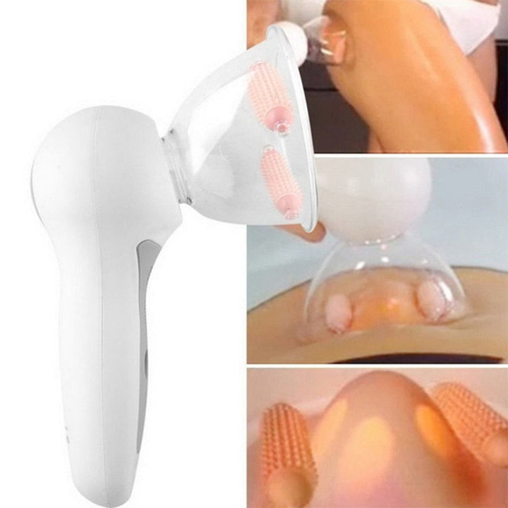Vacuum Anti-Cellulite Massager – SkinSculpt-State of Style