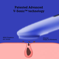 Waterdichte Oplaadbare Gezichtsreinigingsborstel-Roze-State of Style