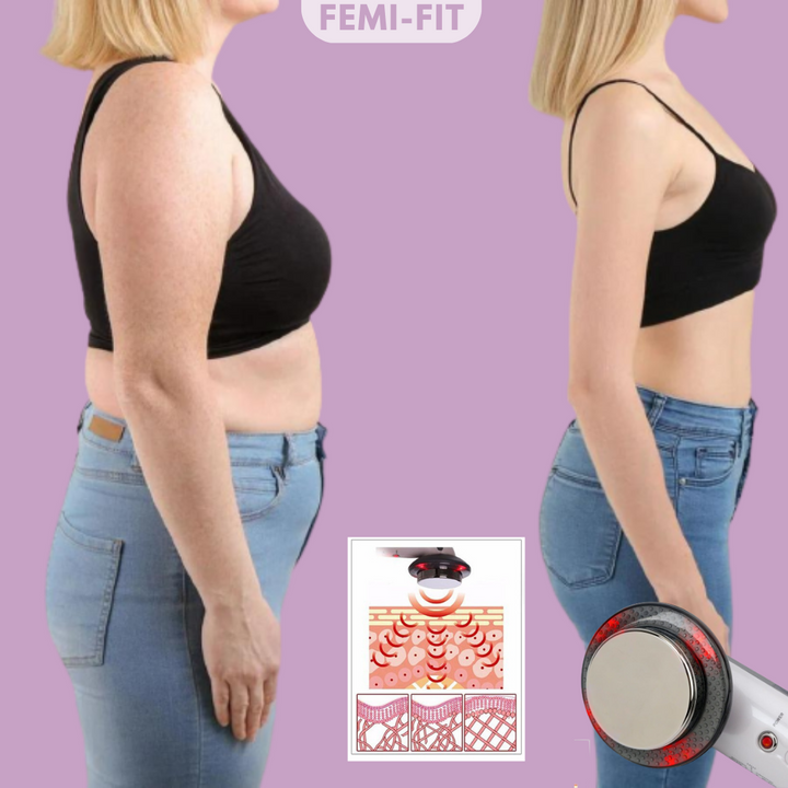 3-in-1 Vet and Cellulite Remover - SlimShape-State of Style