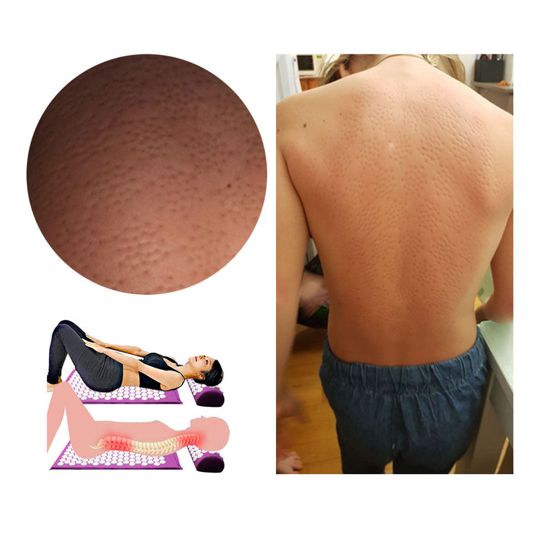 Acupressure Yoga Mat & Cushion Set - RelaxMat-Purple-State of Style