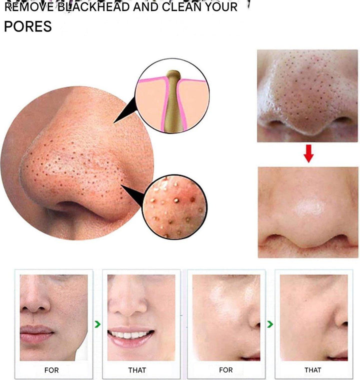 ClearFace | Pore Cleaner-White-State of Style