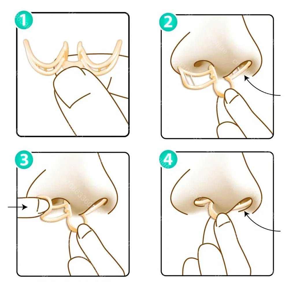 Comfortable Anti-Snoring Device – AirEase-1 Piece-State of Style