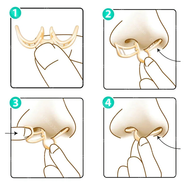 Comfortable Anti-Snoring Device – AirEase-1 Piece-State of Style