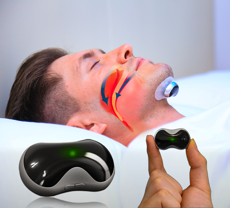 Comfortable Anti-Snoring Device - QuietWave-QuietWave Device-State of Style