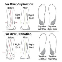 Comfortable orthopedic summer shoes with cushioning – Tessa-Black-3.5-State of Style