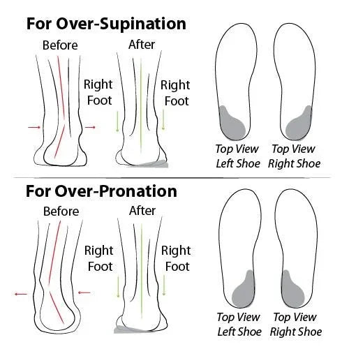 Comfortable orthopedic summer shoes with cushioning – Tessa-Black-3.5-State of Style