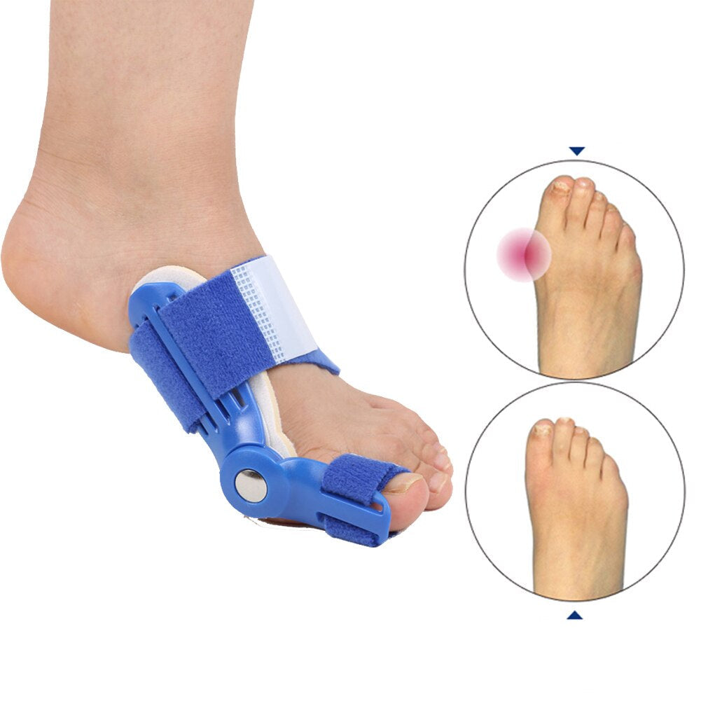 Corrective Bunion Splint (1 Pair) – BunionFix-White-State of Style