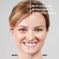 EMS FACE LIFT WITH LED THERAPY - SLIMMER FACE AND DOUBLE CHIN REMOVAL-State of Style