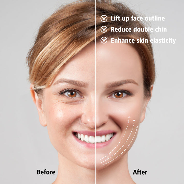 EMS FACE LIFT WITH LED THERAPY - SLIMMER FACE AND DOUBLE CHIN REMOVAL-State of Style