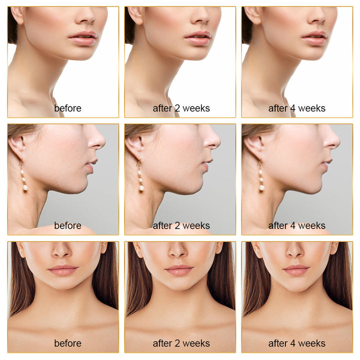 EMS FACE LIFT WITH LED THERAPY - SLIMMER FACE AND DOUBLE CHIN REMOVAL-State of Style