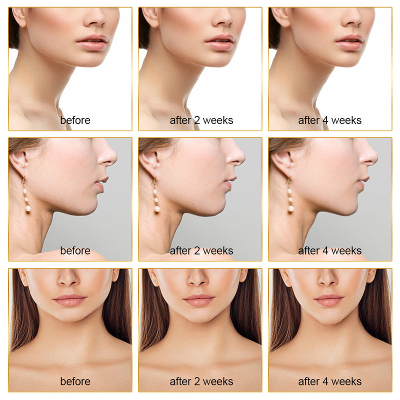 EMS FACE LIFT WITH LED THERAPY - SLIMMER FACE AND DOUBLE CHIN REMOVAL-State of Style