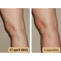 Foot Massage Mat - AcupressureFlow-State of Style