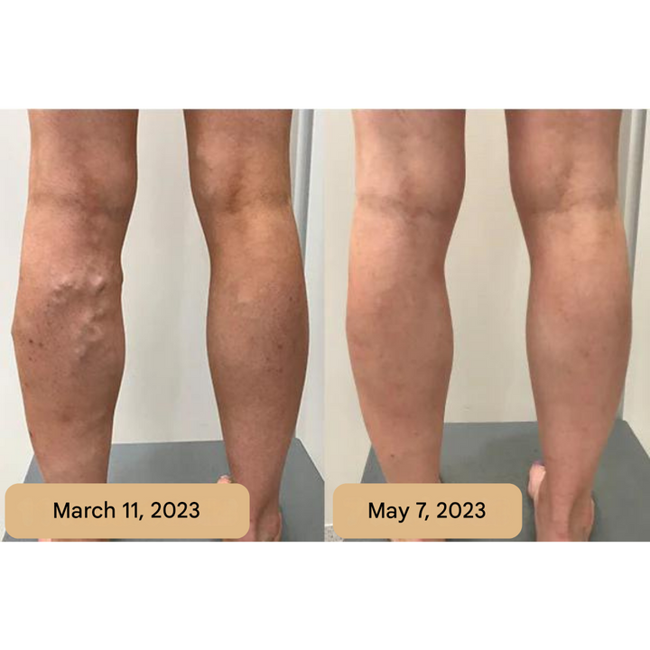 Foot Massage Mat – AcupressureFlow-State of Style