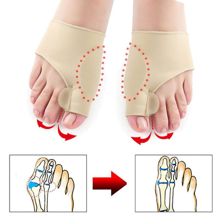 Hallux Valgus Protector (1 pair) - OrthoBunion-State of Style