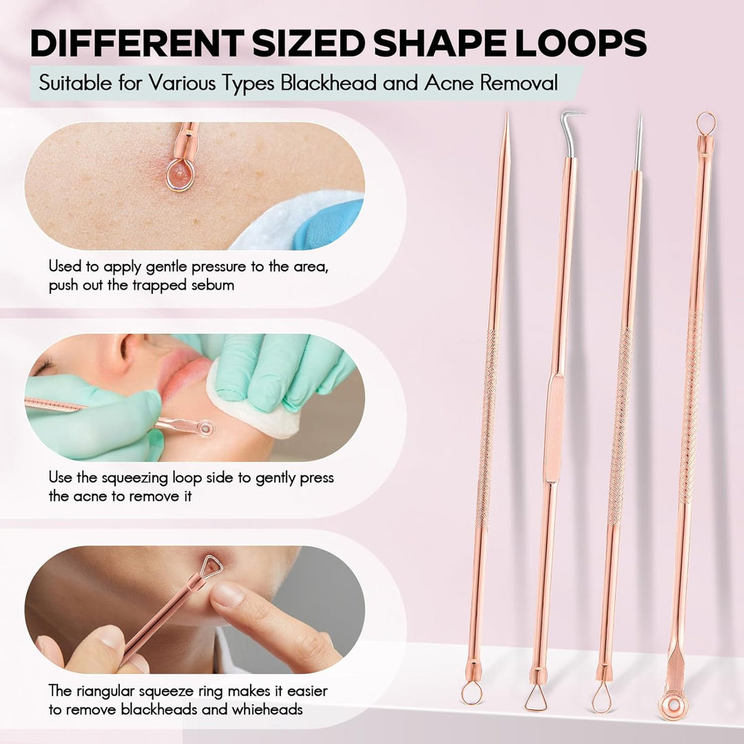 Mee-eter & Park Removal Kit-State of Style