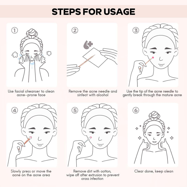 Mee-eter & Park Removal Kit-State of Style