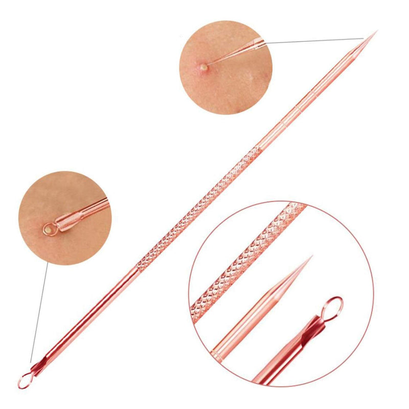 Mee-eter & Park Removal Kit-State of Style