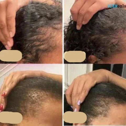 Natural Hair Growth Oil - PureGrowth-1 Piece-State of Style