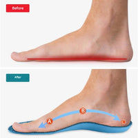 Orthopaedic Insoles – StepRelief-4.5-5.5-State of Style