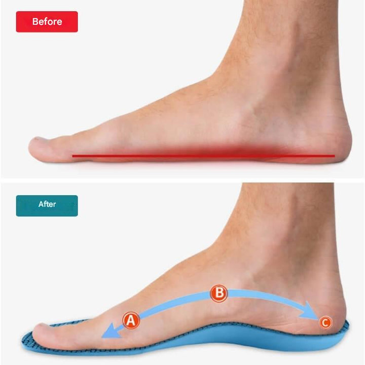 Orthopaedic Insoles – StepRelief-4.5-5.5-State of Style