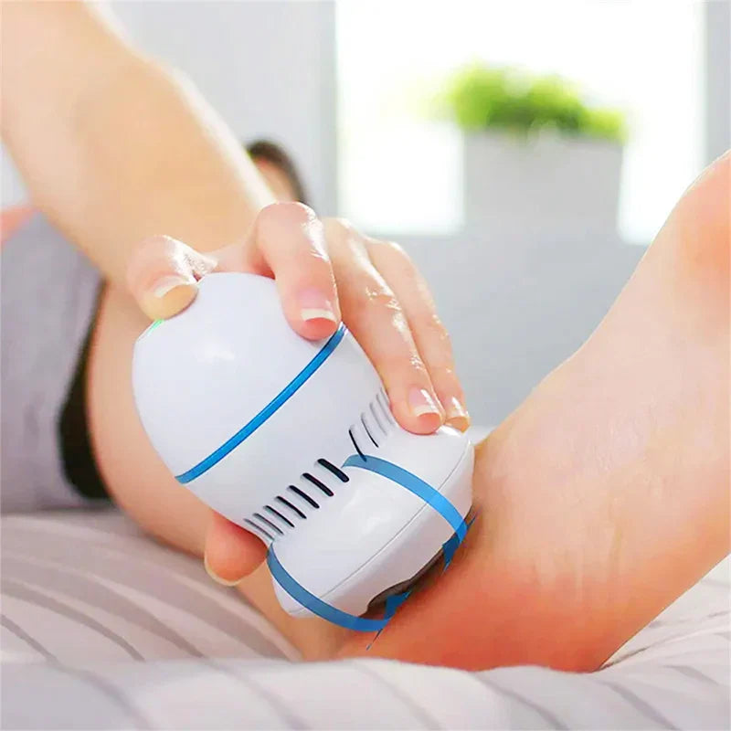 Professional Electric Callus Remover - SoleCare-State of Style