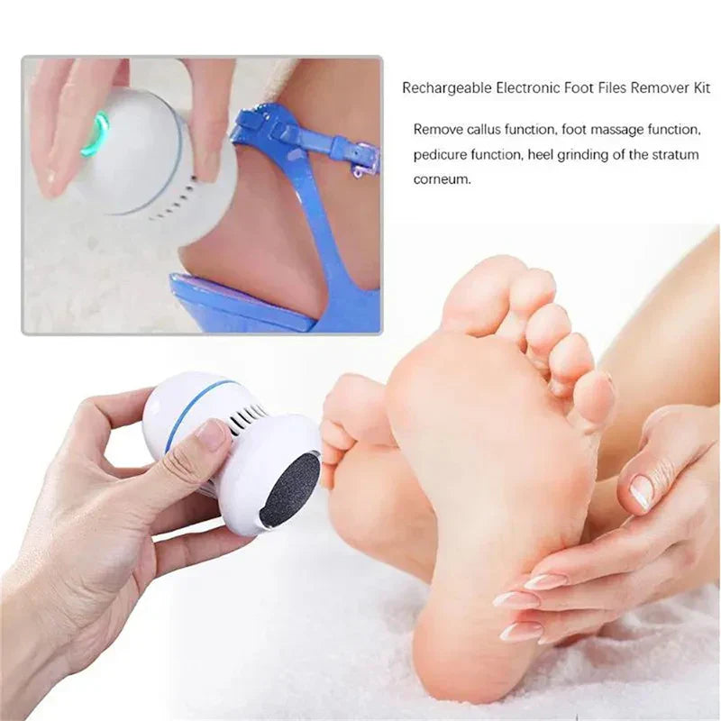 Professional Electric Callus Remover - SoleCare-State of Style