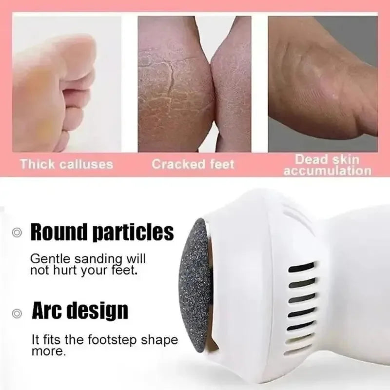 Professional Electric Callus Remover - SoleCare-State of Style