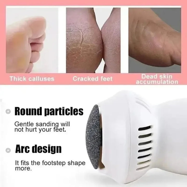 Professional Electric Callus Remover - SoleCare-State of Style