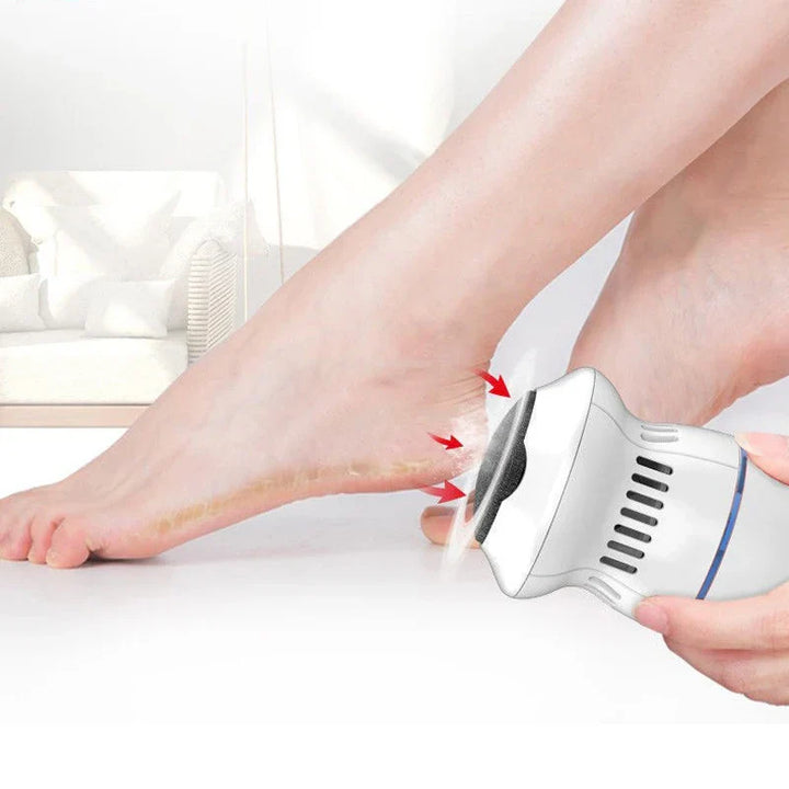 Professional Electric Callus Remover - SoleCare-State of Style