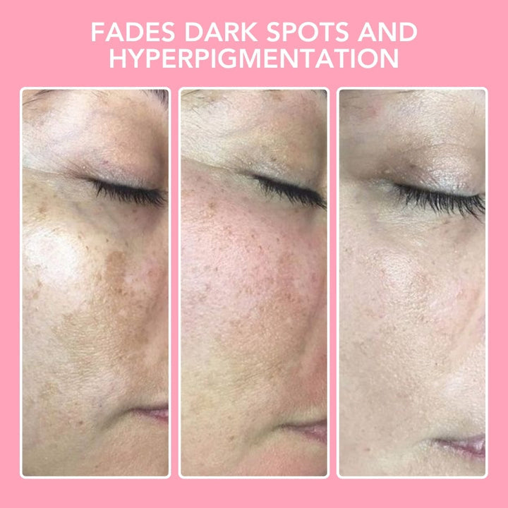 Turmeric Kojic Acid Cleansing Pads - GlowTonic-State of Style