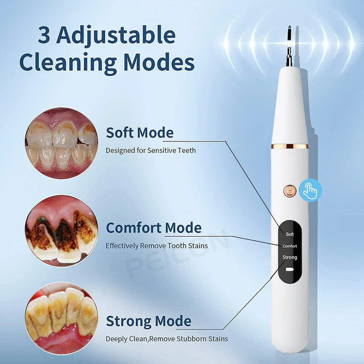 Ultrasonic Tooth Cleaner - SonicClean-White-State of Style