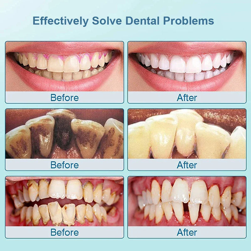 Ultrasonic Tooth Cleaner - SonicClean-White-State of Style