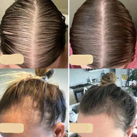 Natural Hair Growth Oil - PureGrowth