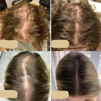 Natural Hair Growth Oil - PureGrowth